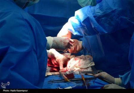 ماجرای ترسناک عمل جراحی در اردوگاه عنبر