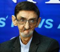 جانباز ۷۰% همدانی به شهدا پیوست