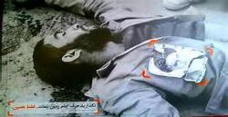 یک شهادت بی درد!